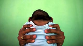 España: detectan primer feto con microcefalia asociado al zika