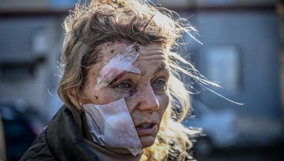 Helena, una maestra de 53 años, se encuentra frente a un hospital después del bombardeo de la ciudad de Chuguiv, en el este de Ucrania, el 24 de febrero de 2022. (ARIS MESSINIS / AFP).