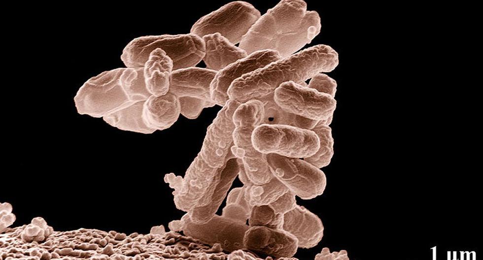 Estudio afirma que bacteria intestinal E.coli puede viajar a través de la uretra hasta la vejiga y causar \"dolorosas infecciones\" urinarias. (Foto: wikimedia)