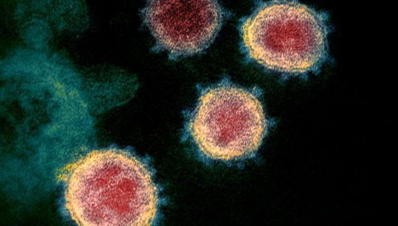 Un laboratorio del Instituto Nacional de Alergias y Enfermedades Infeccionas de Estados Unidos (NIAID, por sus siglas en inglés), reveló imágenes microscópicas del virus. (NIAID-RML)