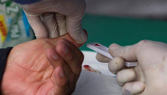 Ecuador detectó el primer caso de la variante ómicron del coronavirus en un hombre que estuvo en Sudáfrica. (Foto: Jose Jacome / EFE)