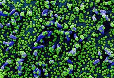 Coronavirus | Cómo se ve el virus cuando invade una célula humana | FOTOS