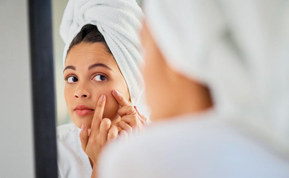 ¿Te preguntas cómo tratar los incómodos puntos negros en el rostro? Conversamos con la dermatóloga Patricia Chávez y estas fueron sus recomendaciones. (Foto: Peopleimages).
