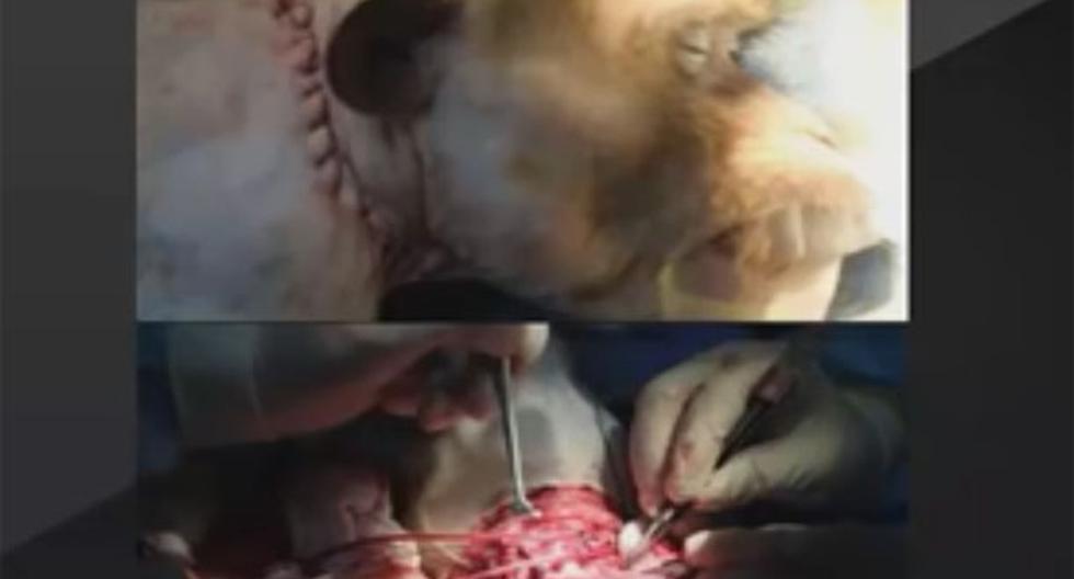 Un cirujano chino habría realizado exitosamente el primer trasplante de una cabeza de mono. (Foto: Captura)