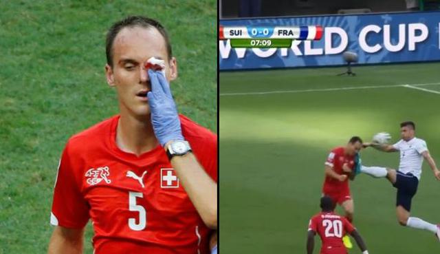 La terrible patada que obligó a jugador suizo dejar el campo - 1