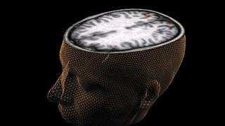 Científicos descubren zona del cerebro que ayudaría a predecir crímenes
