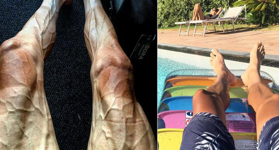 El polaco muestra al mundo cómo quedan sus piernas tras una exigente prueba en el Tour de Francia | Foto: Instagram
