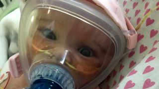 Reino Unido: bebé de seis meses lucha contra el coronavirus conectada a una máquina de oxígeno 