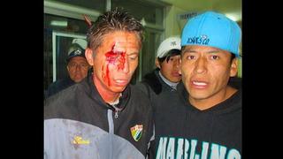 Sangre en la Copa Perú: falló un penal y casi lo linchan