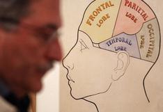 Cuba, Canadá y China se unen para trazar el mapa del cerebro humano