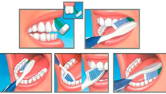 Salud bucal: ¿cuál es la manera correcta de cepillarse los dientes? Foto: Difusión.