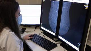 Al menos el 50% de las mujeres obtiene falsos positivos de cáncer de mama en la mamografía, según estudio