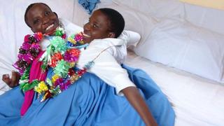 Las mellizas siamesas de Tanzania cuya muerte a los 21 años conmovió al país