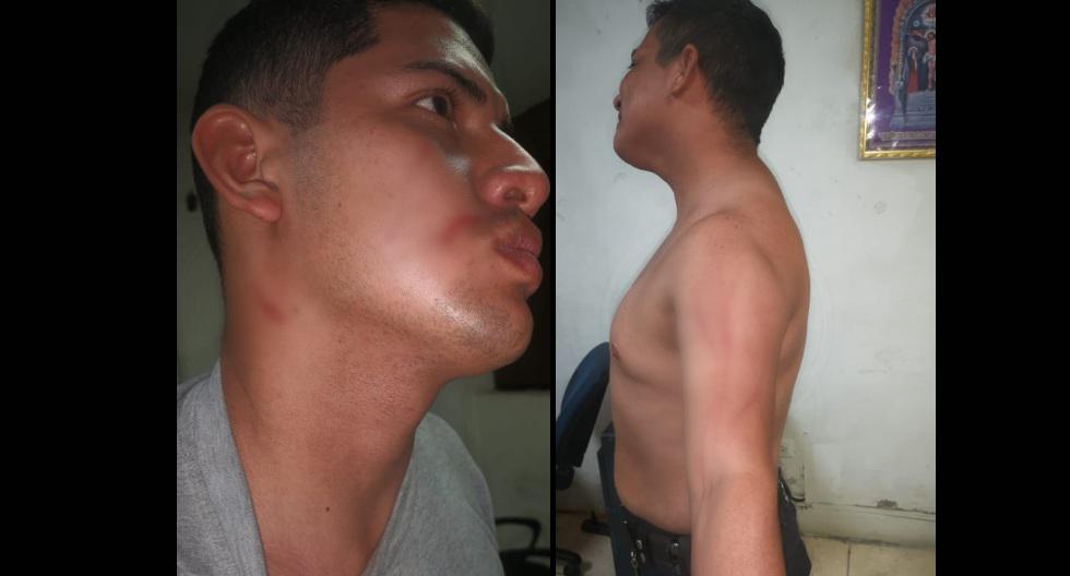 Piura: Policías son agredidos en intervención de 6 personas que jugaban fútbol durante ‘toque de queda’