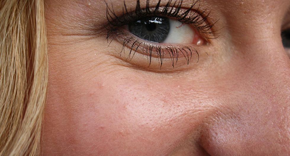Estos hábitos te ayudarán a prevenir las arrugas. (Foto: Pixabay)