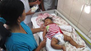 Chiclayo: amputarán brazo a bebé que fue mordida por serpiente