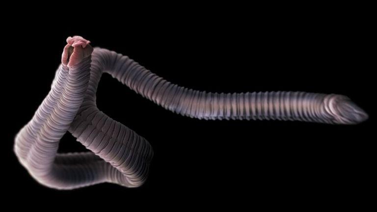 Aunque la mayoría de los protozoos y los helmintos son, por lo general, no patógenos, algunos sí pueden producir enfermedades graves en los seres humanos. (Foto: Getty)