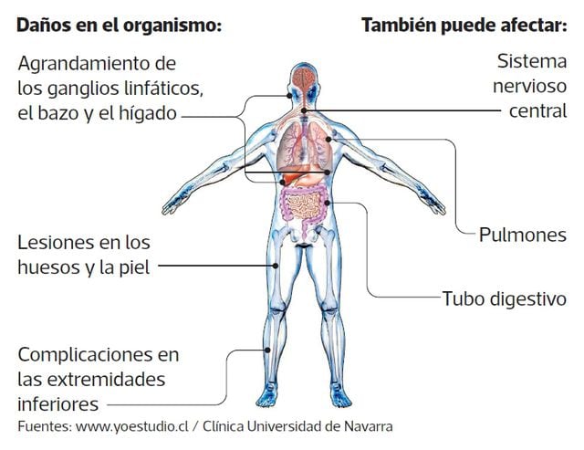 Ciencias Salud Virus HTLV El Hermano Menor Del VIH NOTICIAS EL   5ABTRQ3CINHZDNJTB7Q5VFQ3N4 