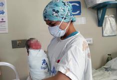 EsSalud Arequipa: Cerca 600 bebés prematuros nacen cada año y son atendidos en el Hospital Carlos Alberto Seguin 