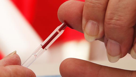 La realización de test de VIH es clave en la lucha contra el sida. (Foto: VALERY HACHE / AFP)