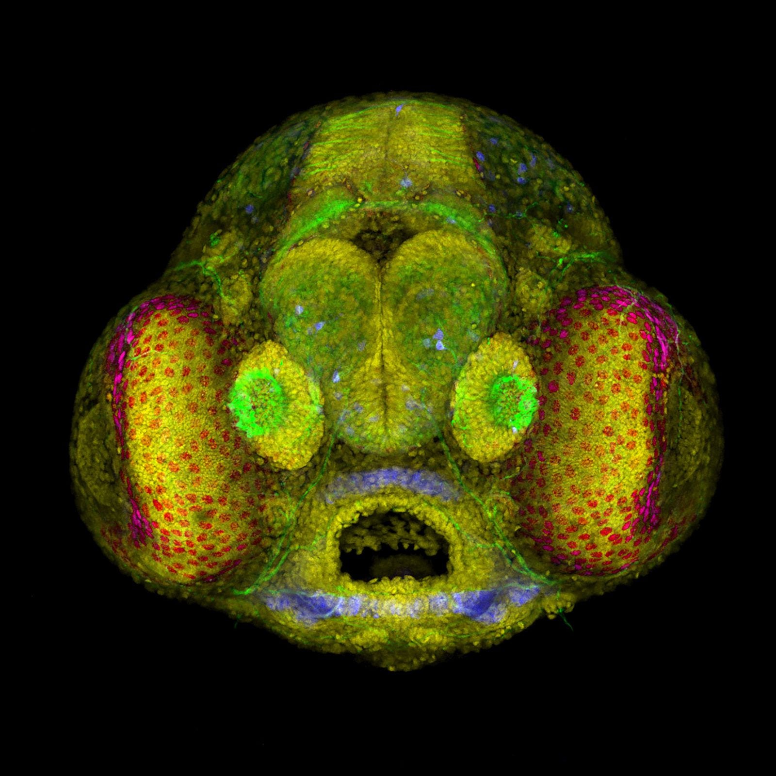 Head of the embryo of a fish.  (Photo: Nikon Small World/Layra G. Cintrón-Rivera)