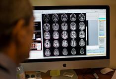 Los genes de la esquizofrenia protegen del Alzheimer, según un estudio
