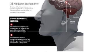 Una nueva mirada al mal de Parkinson [VIDEOS]