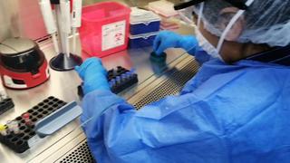 Cusco: entra en funcionamiento laboratorio de biología molecular capaz de procesar 200 pruebas diarias de COVID-19