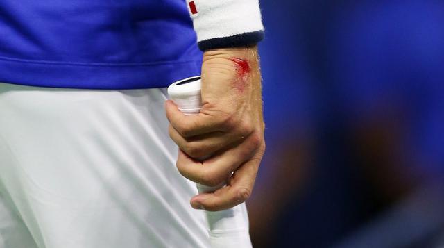 Novak Djokovic: así fue la aparatosa caída que le causó heridas - 2
