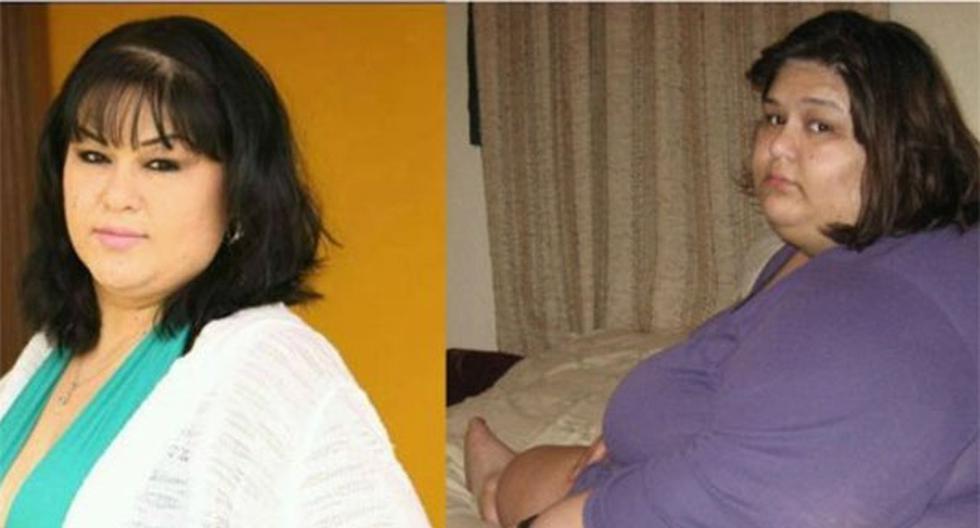 El antes y después de Mayra Rosales tras perder más de 350 kilos. (Foto: Agencias)
