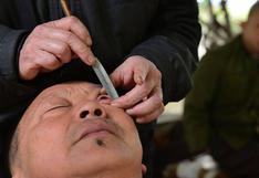 China: Limpian ojos afeitando el globo ocular