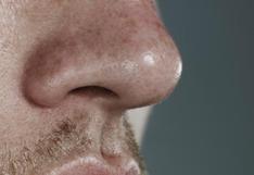 Crean nariz electrónica capaz de distinguir enfermedades del colon