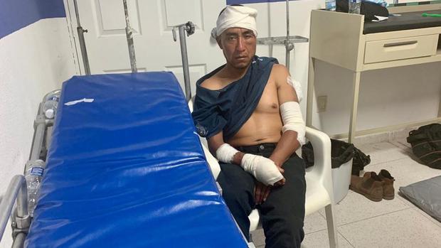 One of the injured who receives care at the Red Cross clinic.  (MARCOS GONZÁLEZ BBC).