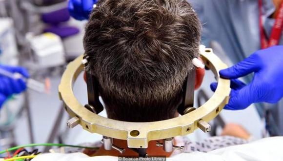 La estimulación cerebral ayuda a las personas con desórdenes del sistema motor. (Foto: Science Photo Library)