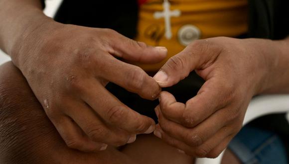 Vista de las manos de una paciente con problemas de adicciones en el Centro de Tratamiento Primario de Desintoxicación de la Mujer en Guayaquil, Ecuador el 6 de enero de 2023.  (Foto: Marcos PIN / AFP)