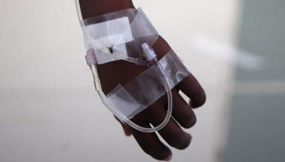 Detalle de una mano de un paciente con síntomas de cólera.