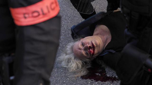 Genevieve Legay | Francia | Las brutales heridas de una anciana durante las protestas de los Chalecos Amarillos. (EFE)
