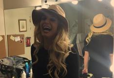 Britney Spears: ¿por qué recibió el 2016 con moretón en la frente? | FOTO 