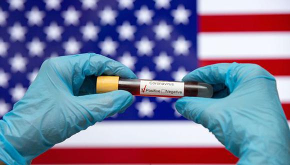 Estados Unidos está muy lejos de la cantidad de testeos por coronavirus que aconsejan los expertos. (Getty Images).