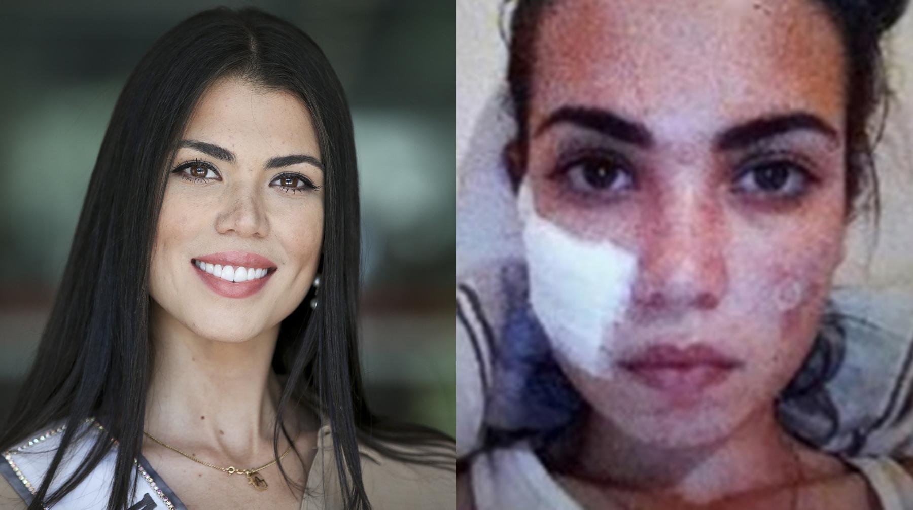 Andrea Díaz, representante chilena a Miss Universo, reveló en redes sociales un momento trágico de su vida. Fotos: Instagram/ Agencias.