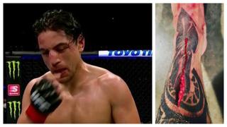 UFC Fight Night: ¡A carne viva! El terrible corte en la pierna del mexicano Benítez, tras el brutal combate ante Morales | FOTO