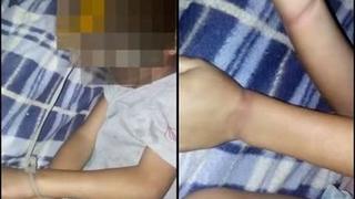 San Martín: madre ataba a su hijo a la cama como castigo