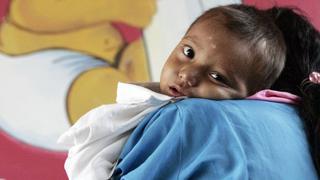 ¿Por qué los niños de Guatemala son los que más desnutrición crónica sufren en América Latina?