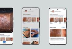 La nueva función de Google Lens te permite saber si la mancha en tu piel necesita ser revisada por un médico