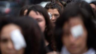La “epidemia” de lesiones oculares en la protestas de Chile que pone en entredicho al gobierno de Piñera