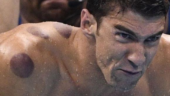 Michael Phelps: ¿por qué lleva círculos rojos en su cuerpo?