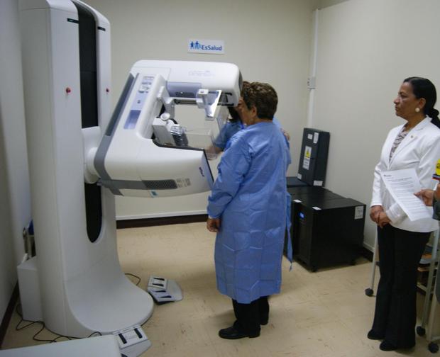 Women over 40 must have a yearly mammogram.  (EsSalud)