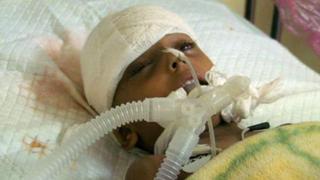 La trágica historia de Asma, una niña atrapada en la guerra