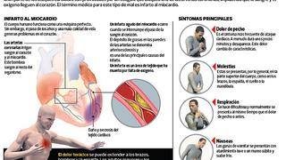 La vida sexual después de un infarto cardíaco