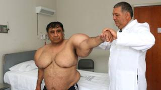 El extraño caso del buzo peruano que tiene el cuerpo “inflado” llega a la BBC